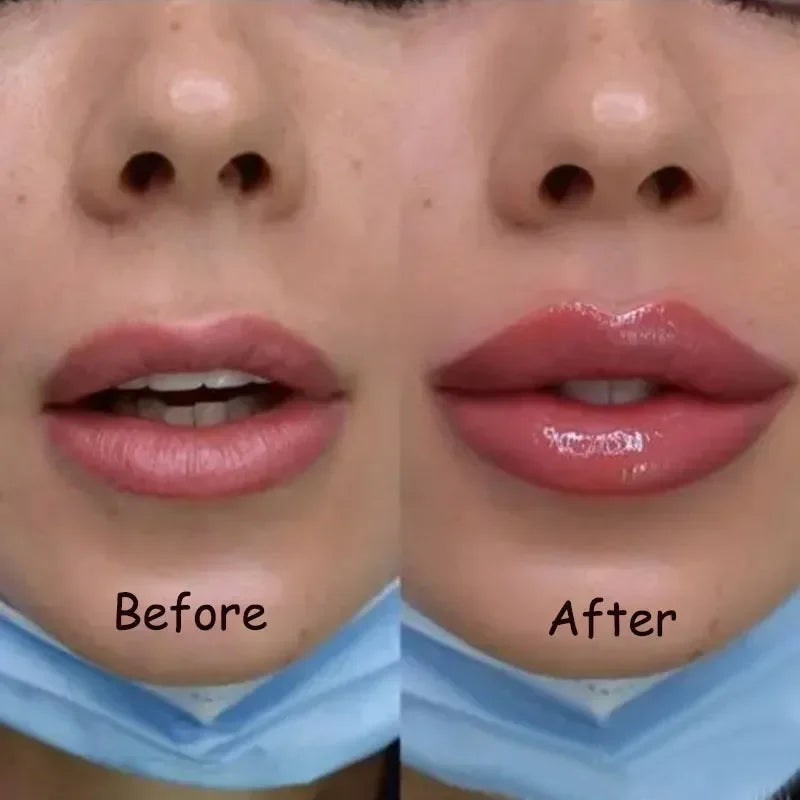 Lip Plump Serum Increase Lip Elasticity - DOFIBA